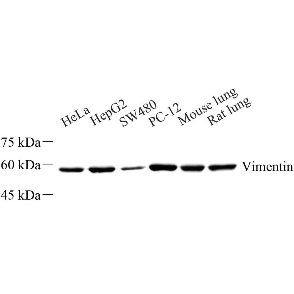 GB11192 Purificación de afinidad anti-vimentina conejo pab
