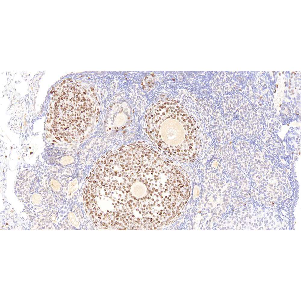 Anti-ki67 conejo PAB para la investigación del cáncer IHC si el anticuerpo primario