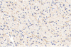 GB11181 anti-antididtirrosina hidroxilasa conejo pab