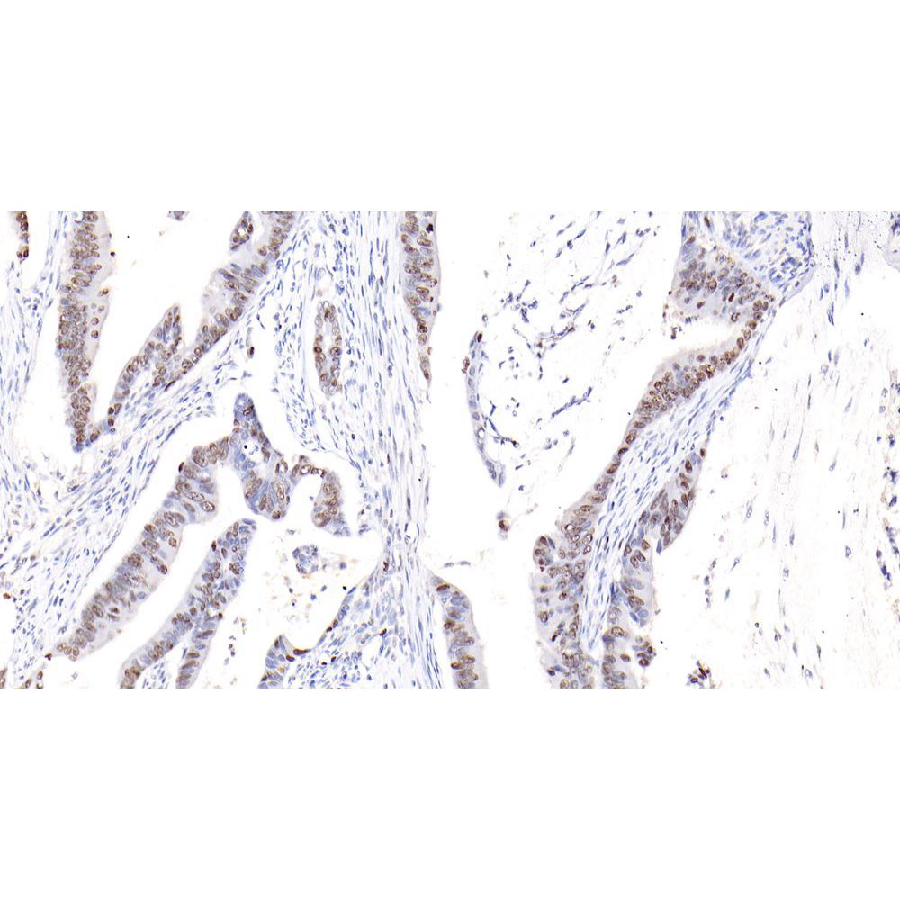 Anti-ki67 conejo PAB para la investigación del cáncer IHC si el anticuerpo primario
