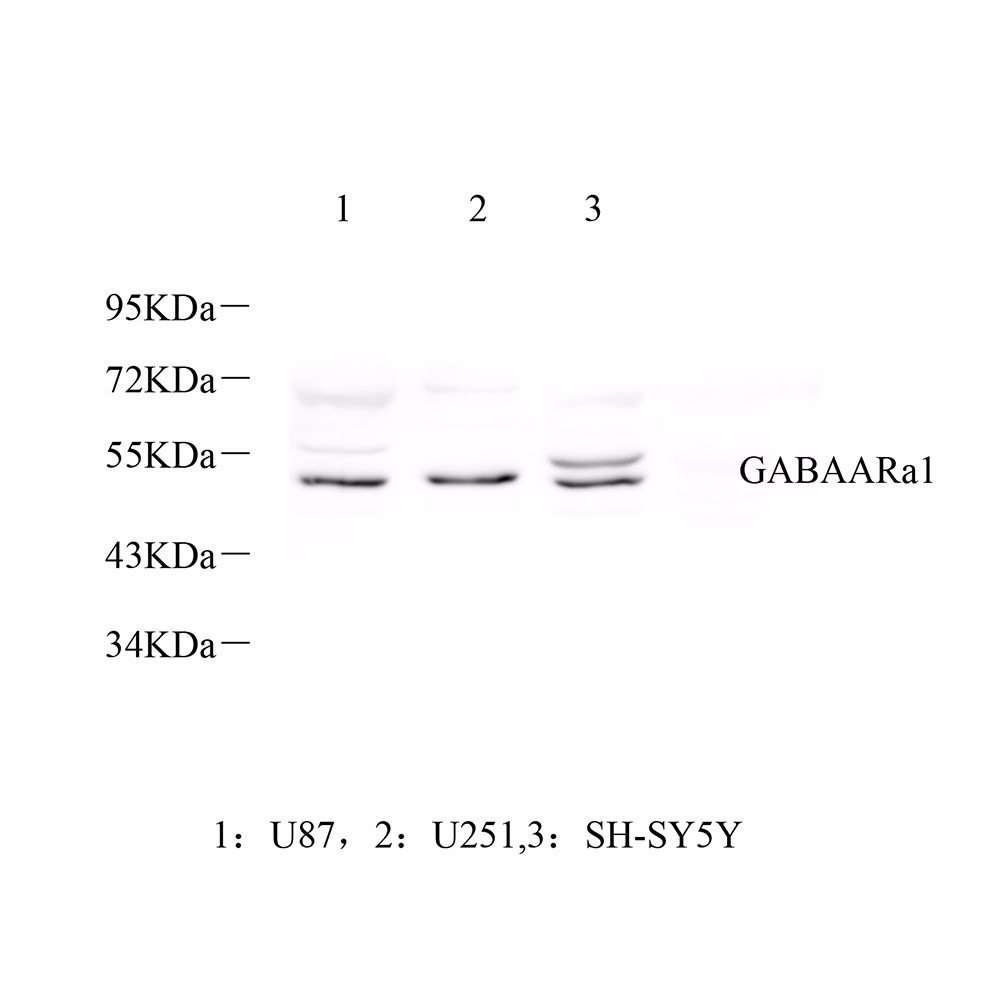 GB11561 anti -gaba un receptor alfa 1 conejo pab