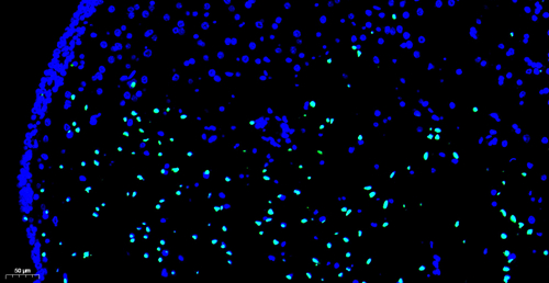 Kit de detección de apoptosis de células CF488 TDT mediada por Dutp Nick Etiquetado
