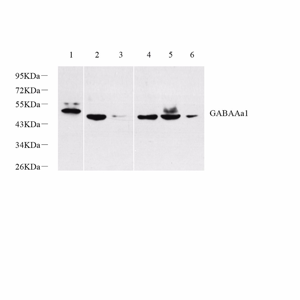 GB11402 Anticuerpo-Gaba Un receptor Alpha 1 (GABAAA1) Conejo PAB Western Blot Anticuerpo