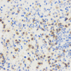 GB11182 Anticuerpo policlonal anti -CD90 / THY1 PAB de conejo