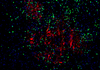 100t kit de tinción doble de fluorescencia de tsaplus para tinción doble de inmunofluorescencia de secciones de parafina