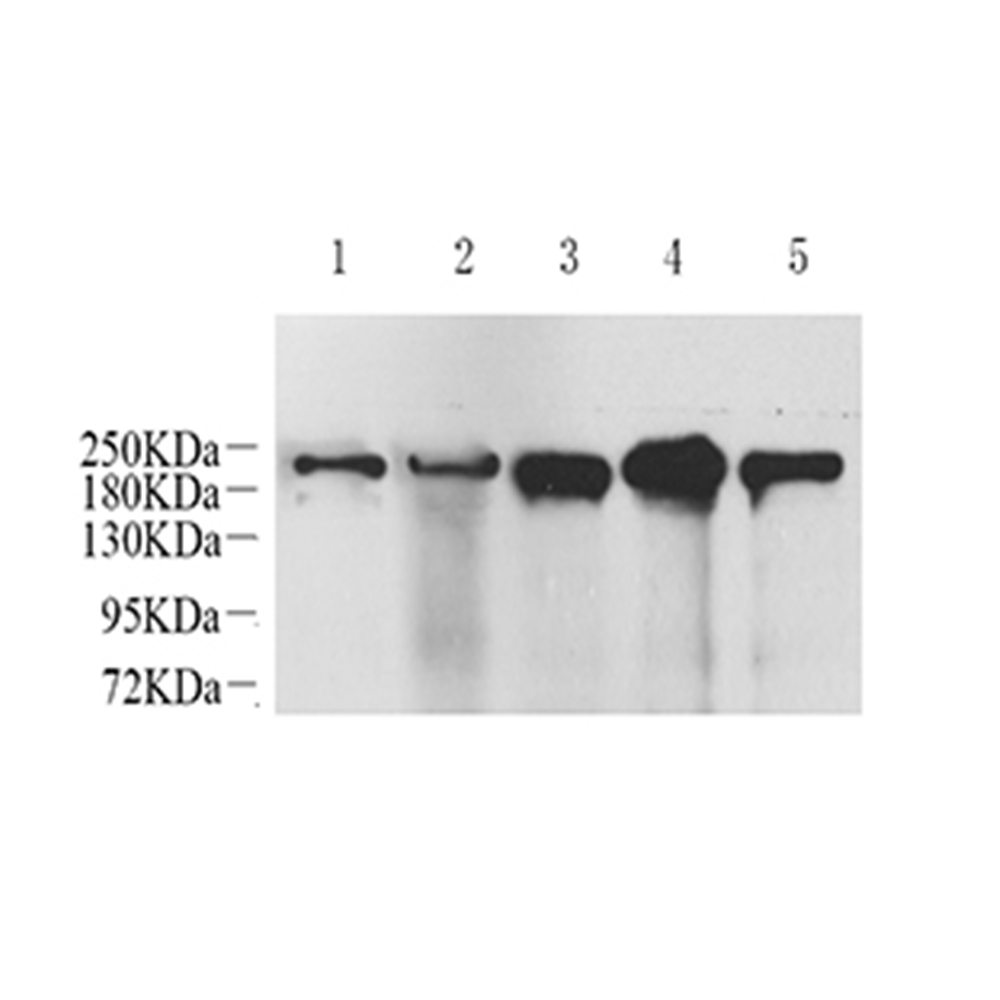 GB11141 anti -neurofilamento pesado polipéptido conejo pab